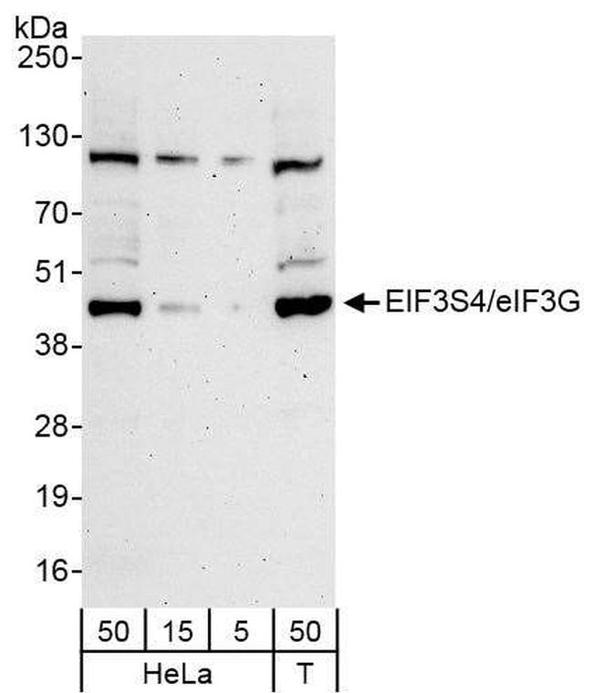 eIF3G/EIF3S4 Antibody in Western Blot (WB)