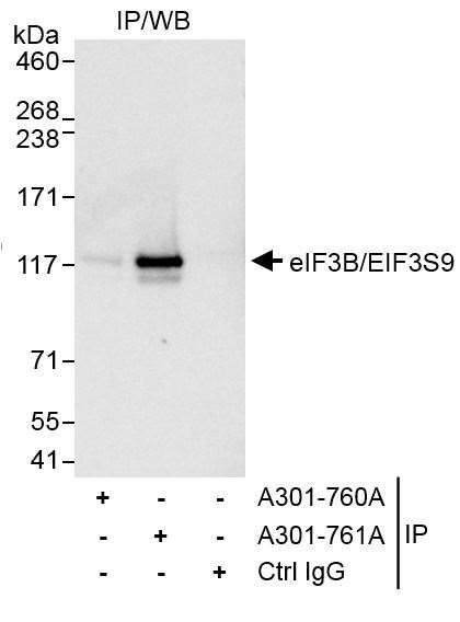 eIF3B/EIF3S9 Antibody in Immunoprecipitation (IP)