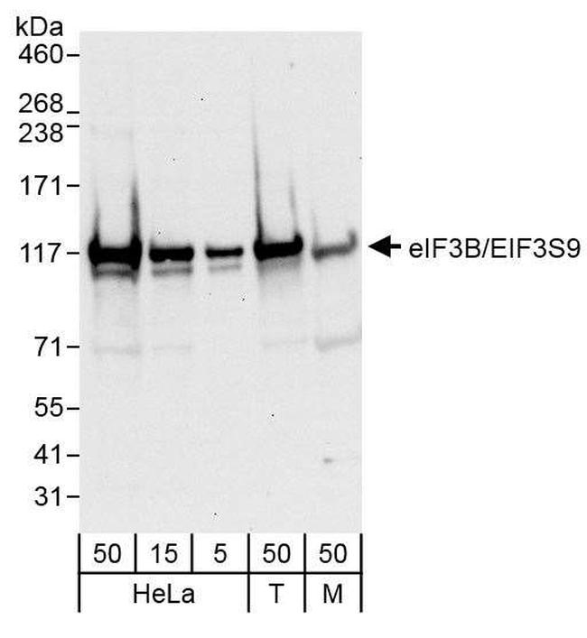 eIF3B/EIF3S9 Antibody in Western Blot (WB)