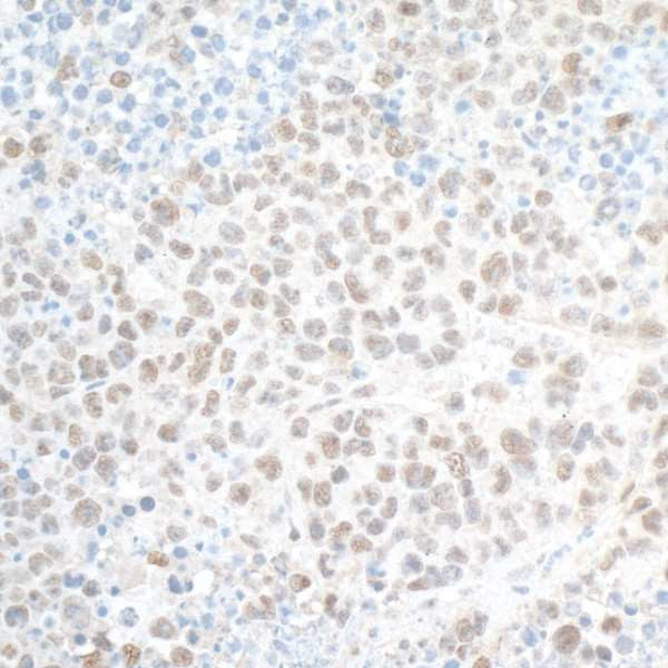 PHF8 Antibody in Immunohistochemistry (Paraffin) (IHC (P))