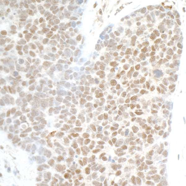 PHF8 Antibody in Immunohistochemistry (Paraffin) (IHC (P))