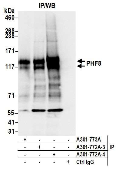 PHF8 Antibody in Immunoprecipitation (IP)