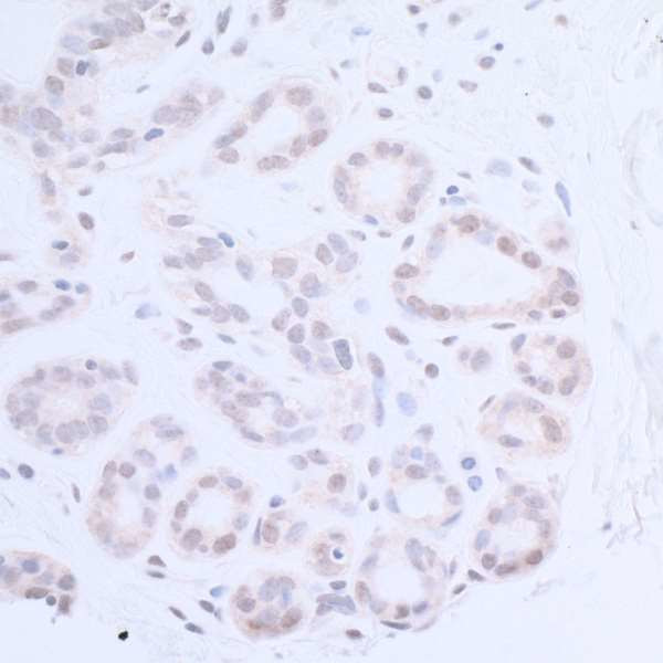 XPA Antibody in Immunohistochemistry (Paraffin) (IHC (P))