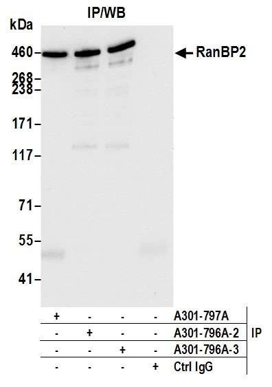 RanBP2 Antibody in Immunoprecipitation (IP)