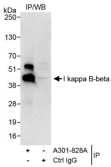 I kappa B-beta Antibody in Immunoprecipitation (IP)