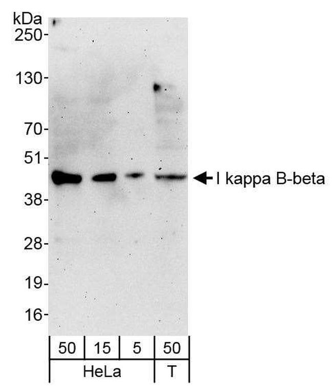 I kappa B-beta Antibody in Western Blot (WB)