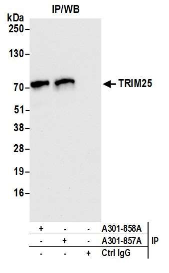 TRIM25 Antibody in Immunoprecipitation (IP)