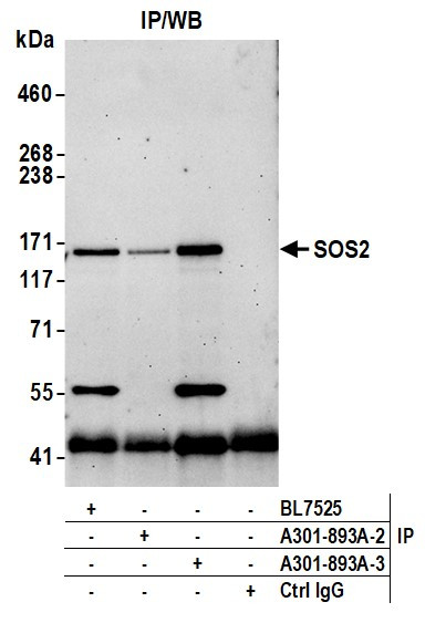 SOS2 Antibody in Immunoprecipitation (IP)