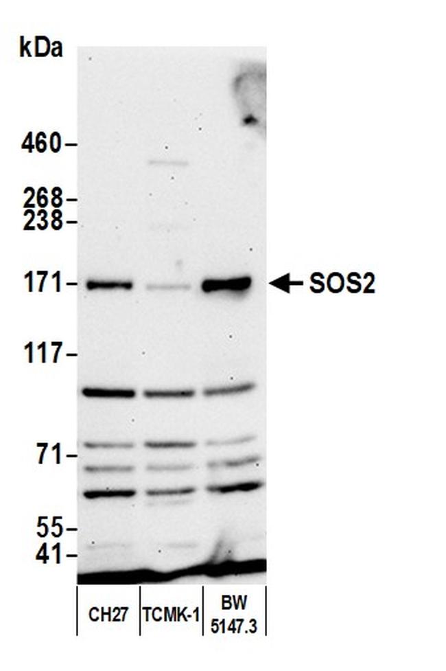 SOS2 Antibody in Western Blot (WB)