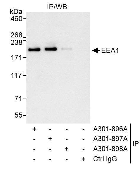 EEA1 Antibody in Immunoprecipitation (IP)