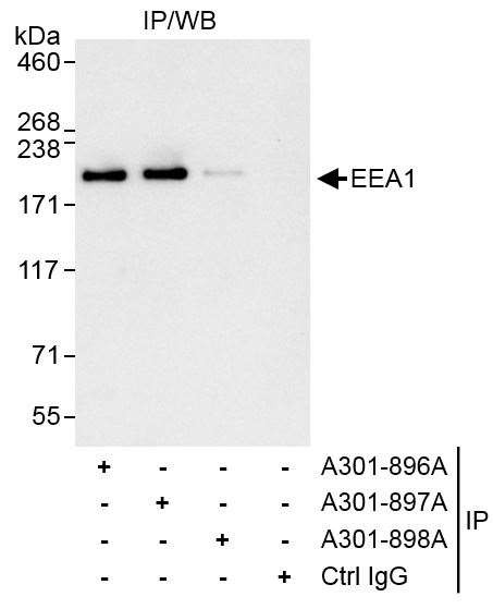 EEA1 Antibody in Immunoprecipitation (IP)