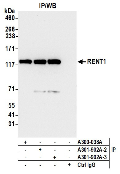 RENT1 Antibody in Immunoprecipitation (IP)
