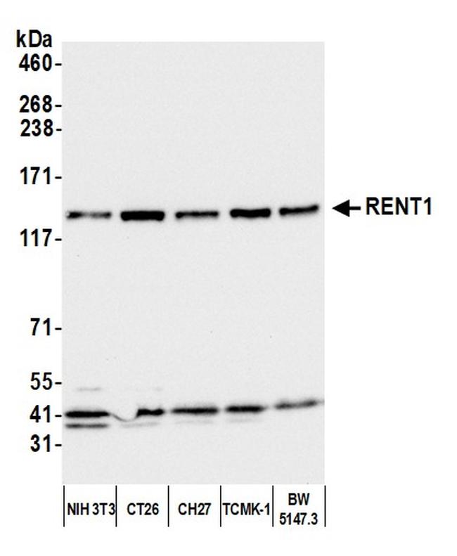 RENT1 Antibody in Western Blot (WB)