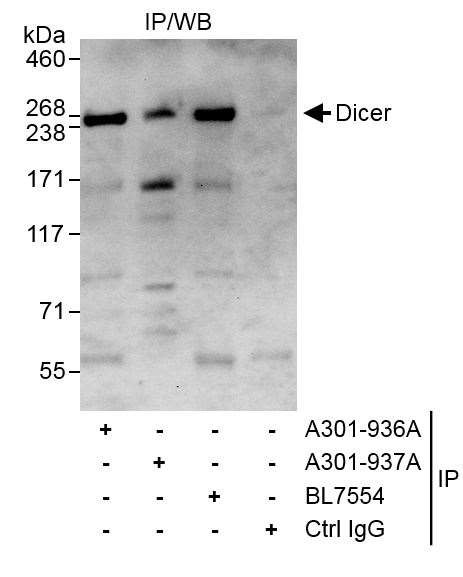 Dicer Antibody in Immunoprecipitation (IP)