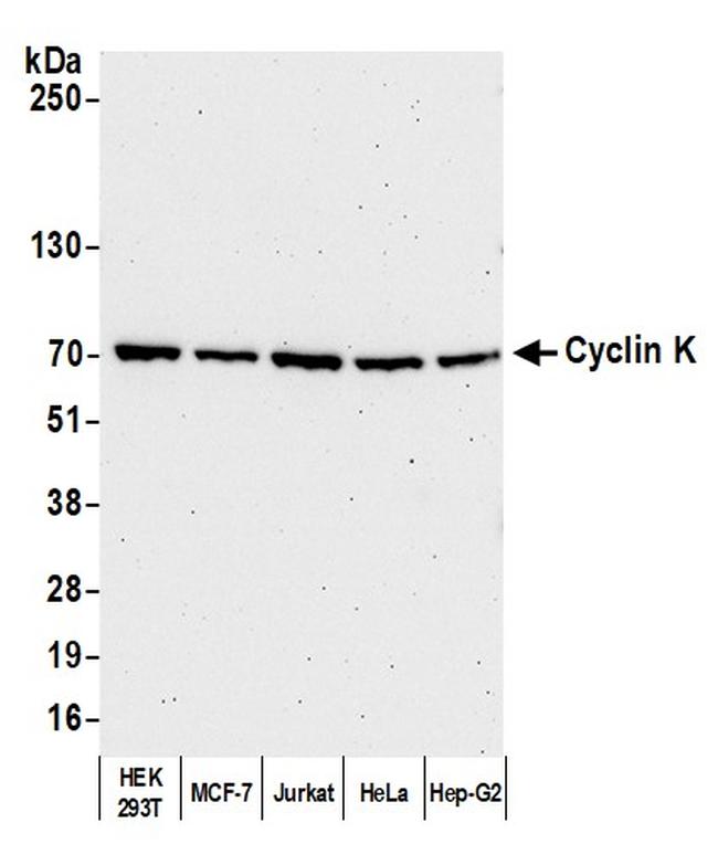 Cyclin K Antibody in Western Blot (WB)