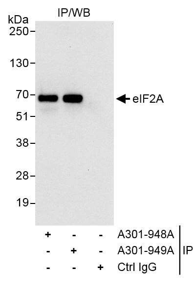 eIF2A Antibody in Immunoprecipitation (IP)