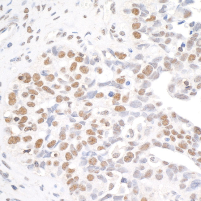 BRD4 Antibody in Immunohistochemistry (Paraffin) (IHC (P))