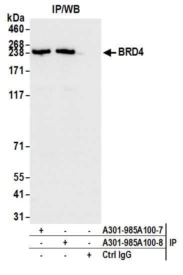 BRD4 Antibody in Immunoprecipitation (IP)