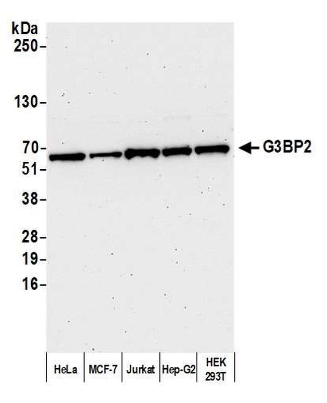 G3BP2 Antibody in Western Blot (WB)