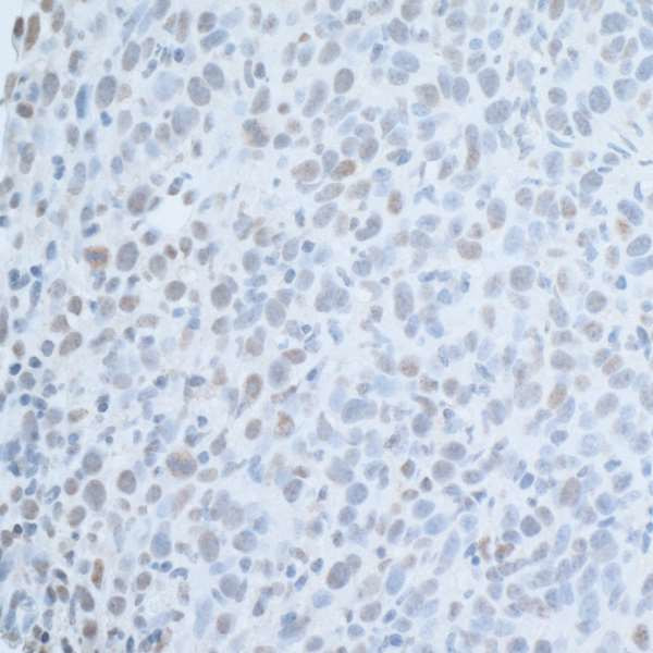 U2AF35 Antibody in Immunohistochemistry (Paraffin) (IHC (P))