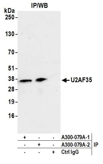 U2AF35 Antibody in Immunoprecipitation (IP)