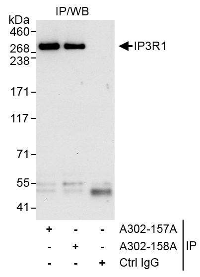 IP3R1 Antibody in Immunoprecipitation (IP)