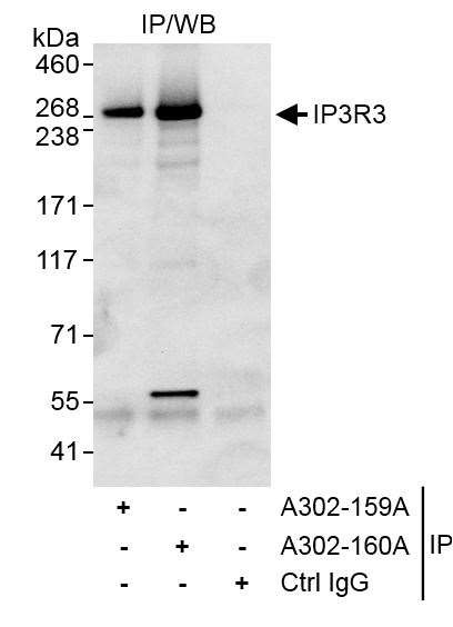 IP3R3 Antibody in Immunoprecipitation (IP)