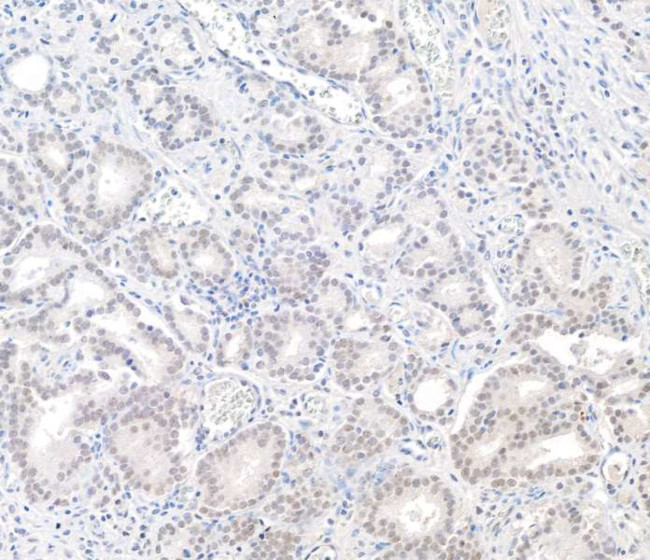 BAP1 Antibody in Immunohistochemistry (Paraffin) (IHC (P))