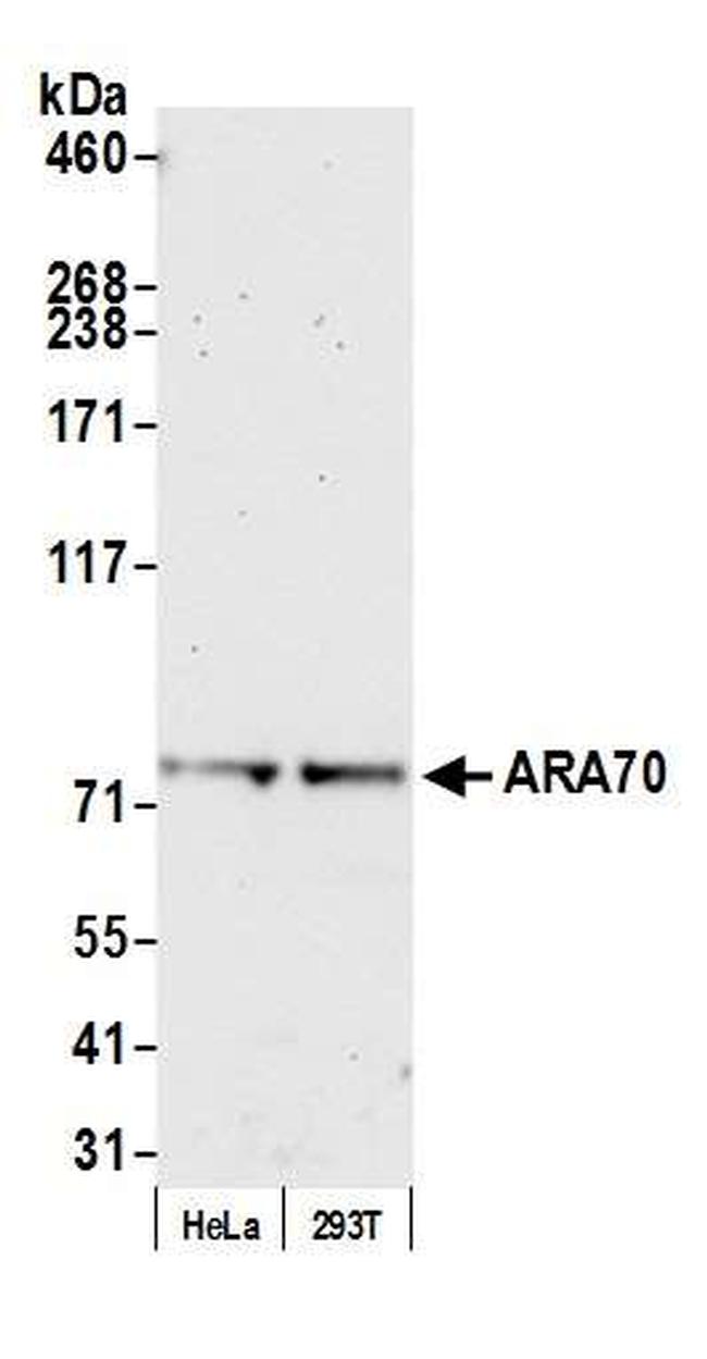 ARA70 Antibody in Western Blot (WB)