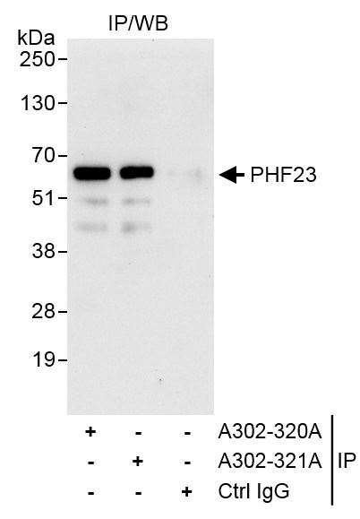 PHF23 Antibody in Immunoprecipitation (IP)