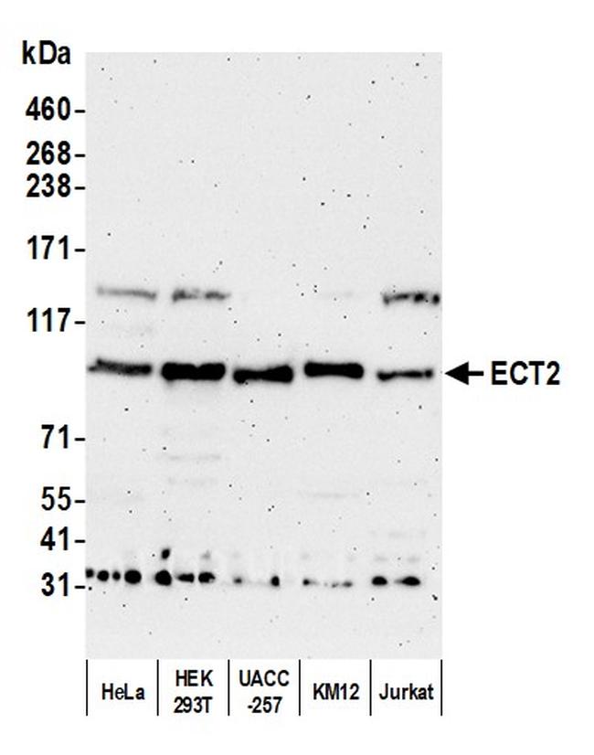 ECT2 Antibody in Western Blot (WB)