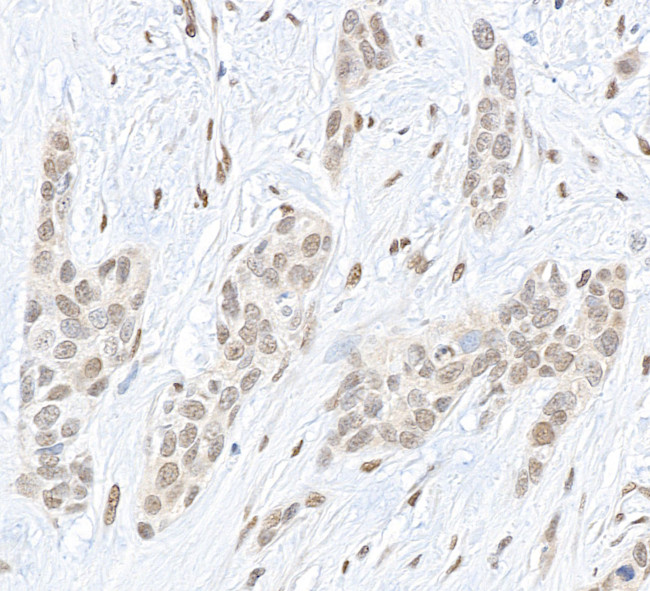 Pc2 Antibody in Immunohistochemistry (Paraffin) (IHC (P))