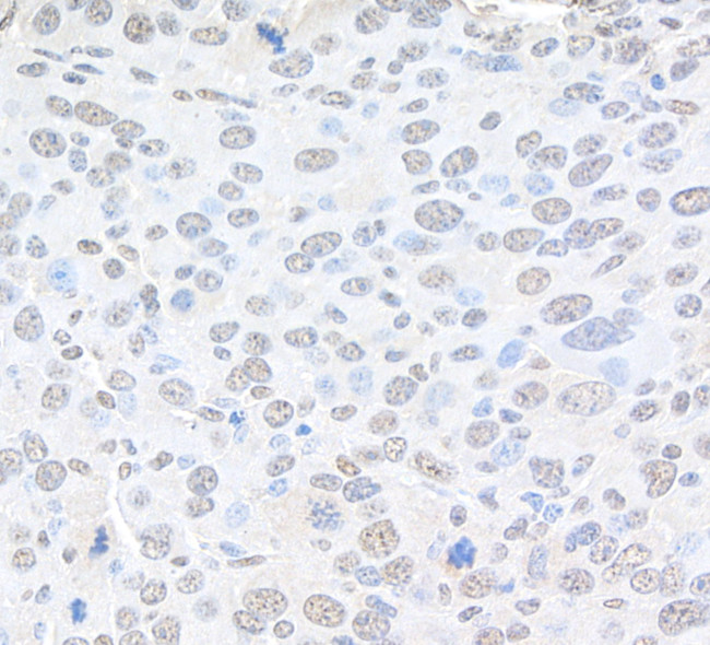 Pc2 Antibody in Immunohistochemistry (Paraffin) (IHC (P))