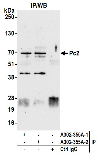 Pc2 Antibody in Immunoprecipitation (IP)