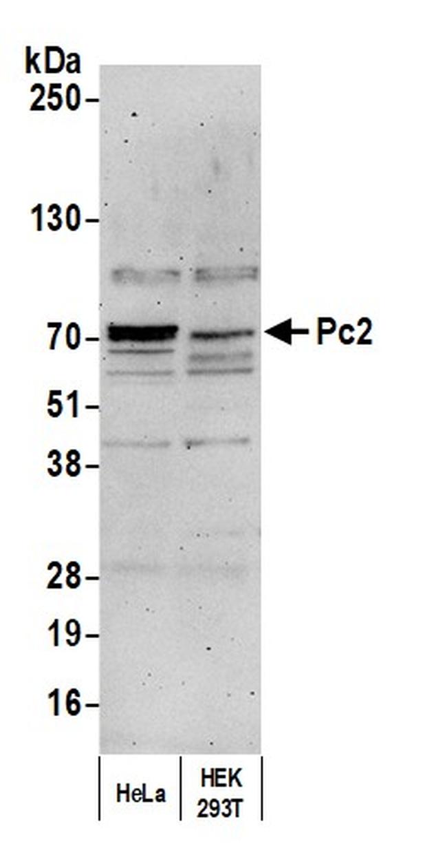 Pc2 Antibody in Western Blot (WB)