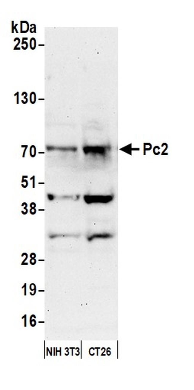 Pc2 Antibody in Western Blot (WB)