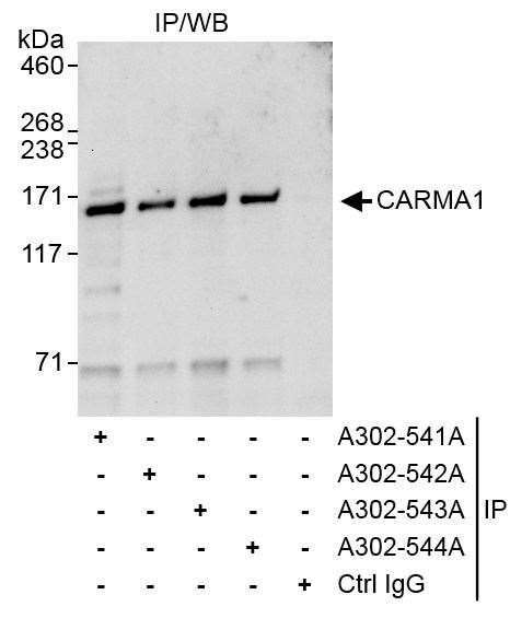 CARMA1 Antibody in Immunoprecipitation (IP)