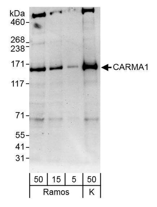 CARMA1 Antibody in Western Blot (WB)