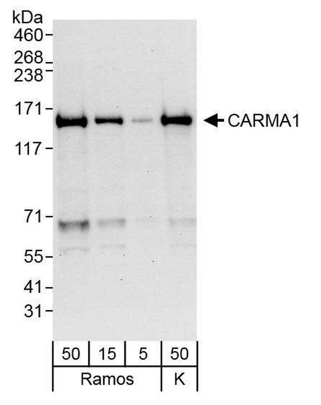 CARMA1 Antibody in Western Blot (WB)