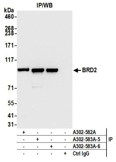 BRD2 Antibody in Immunoprecipitation (IP)