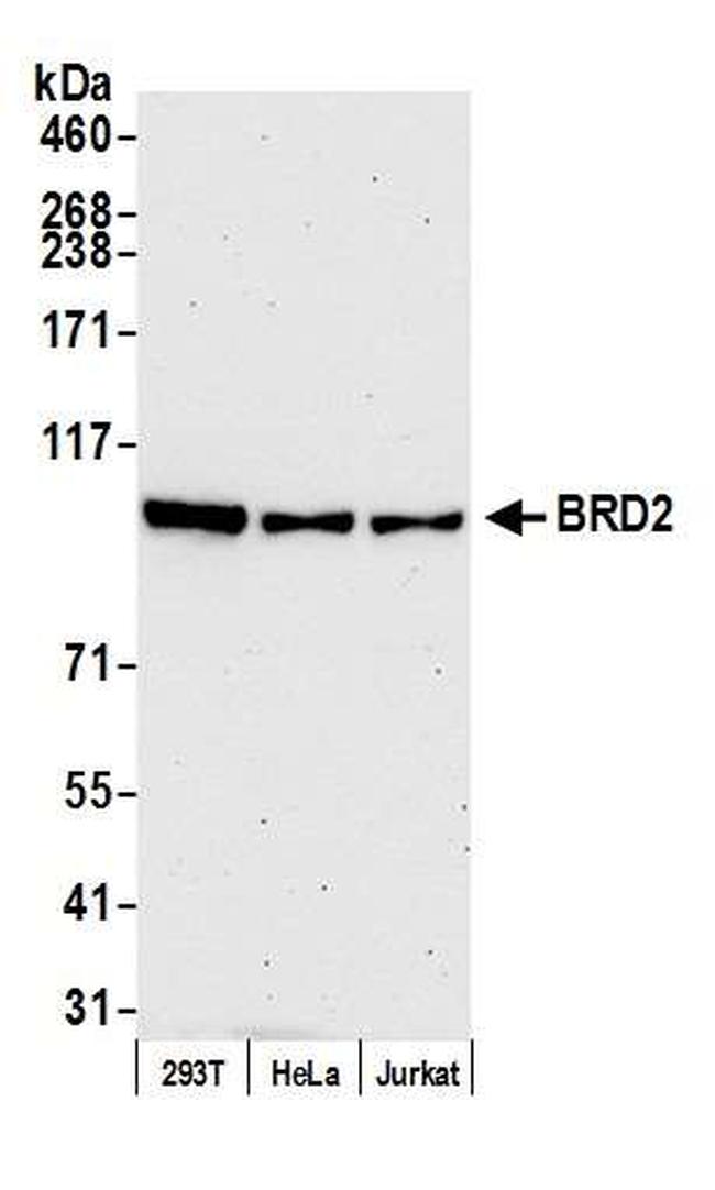 BRD2 Antibody in Western Blot (WB)