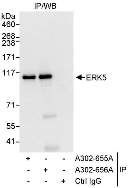 ERK5 Antibody in Immunoprecipitation (IP)