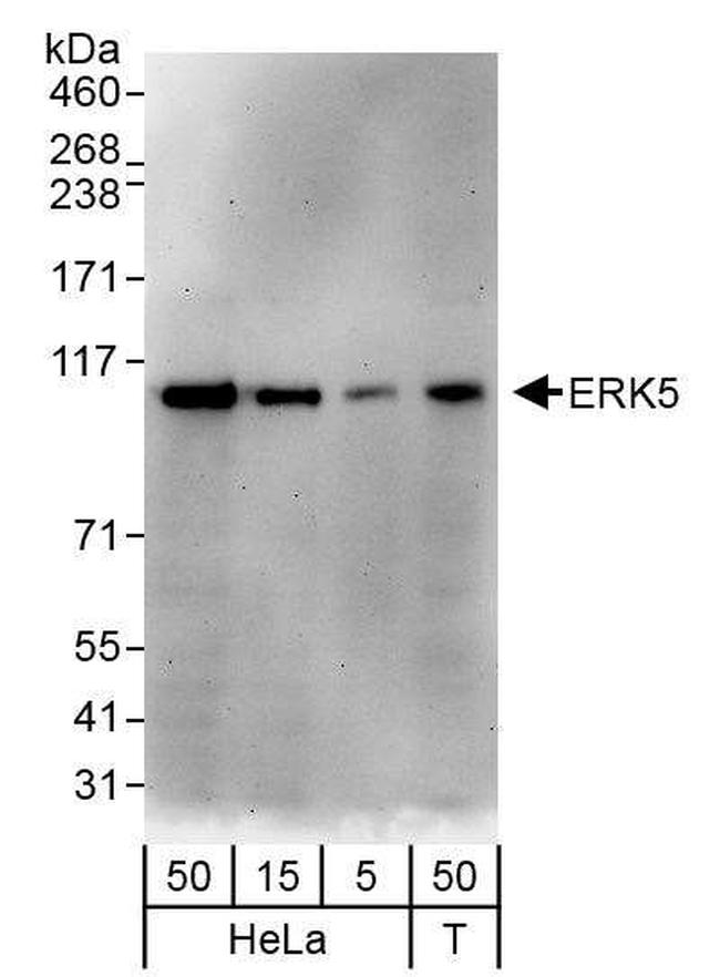 ERK5 Antibody in Western Blot (WB)