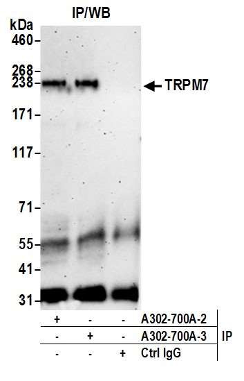 TRPM7 Antibody in Immunoprecipitation (IP)