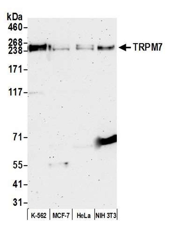 TRPM7 Antibody in Western Blot (WB)