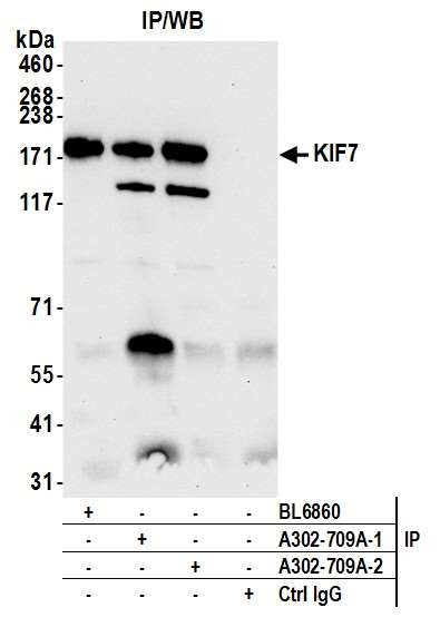 KIF7 Antibody in Immunoprecipitation (IP)