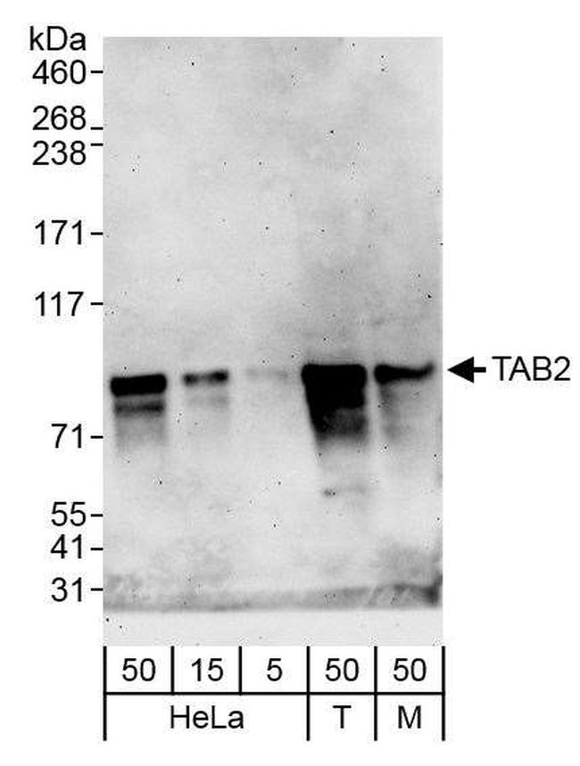 TAB2 Antibody in Western Blot (WB)