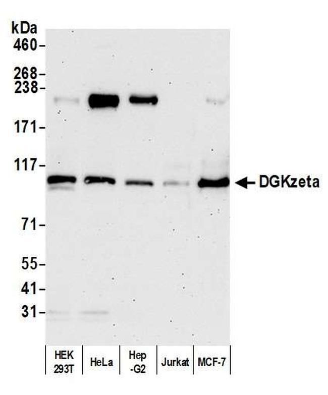 DGKzeta Antibody in Western Blot (WB)