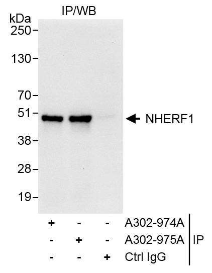 NHERF1 Antibody in Immunoprecipitation (IP)