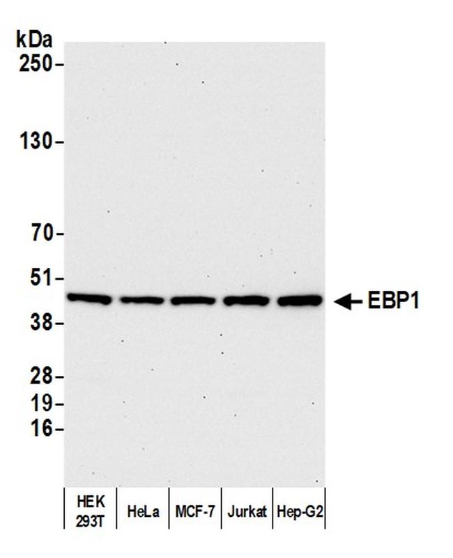 EBP1 Antibody in Western Blot (WB)